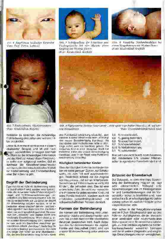 Vorschauseite 2: Beitrag der Kinderkrankenschwester auf der Neugeborenenstation zur Früherkennung von Behinderungen