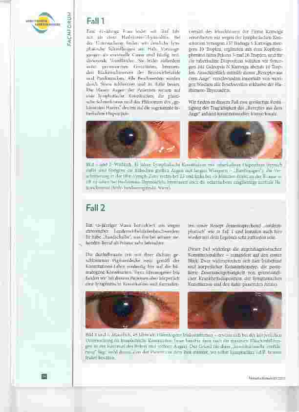 Vorschauseite 4: Die Konstitutionslehre der Irisdiagnose auf dem „Prüfstand“