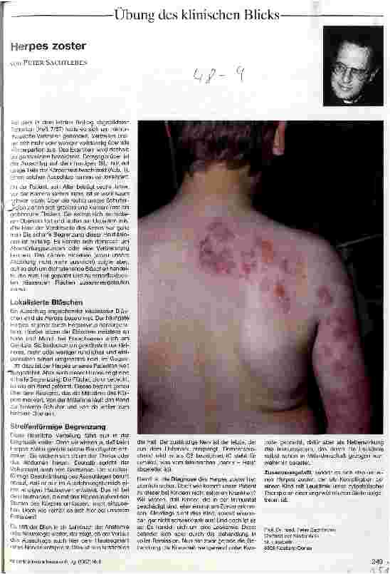 Vorschauseite 1: Herpes zoster