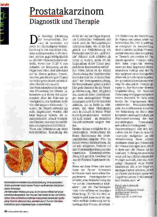 Vorschauseite 1: Prostatakarzinom Diagnostik und Therapie