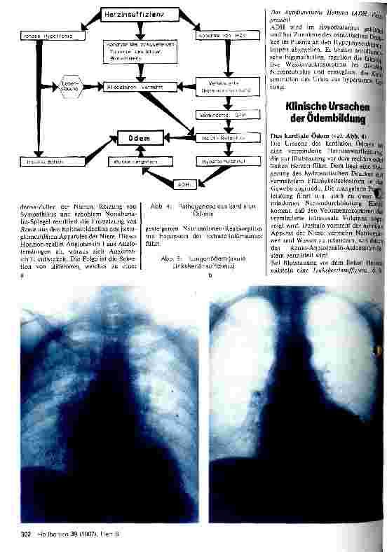 Vorschauseite 2: Die Pathognese der Ödembildung