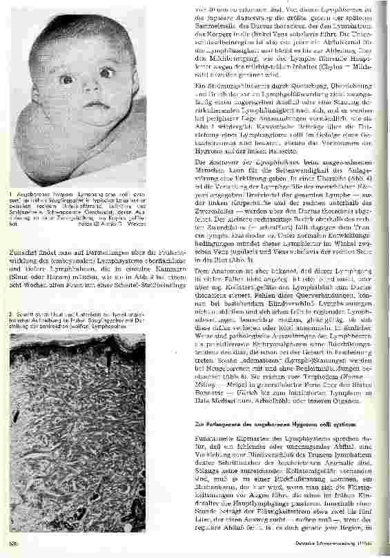 Vorschauseite 2: Das angeborene Hygrom des Halses