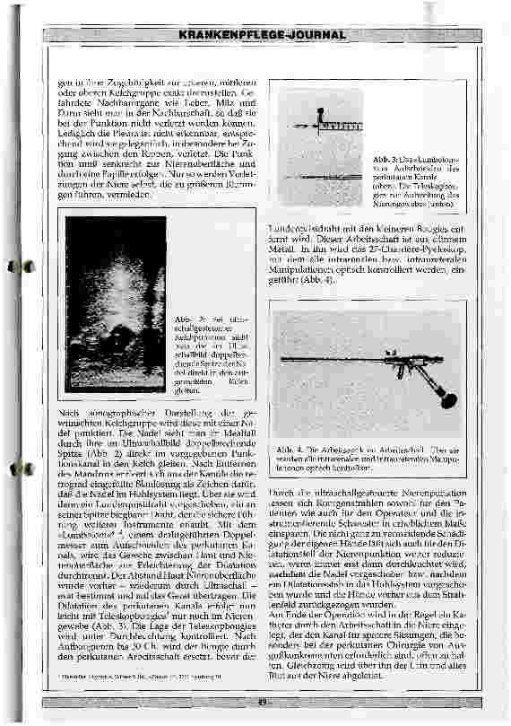 Vorschauseite 2: Perkutane Niereneingriffe