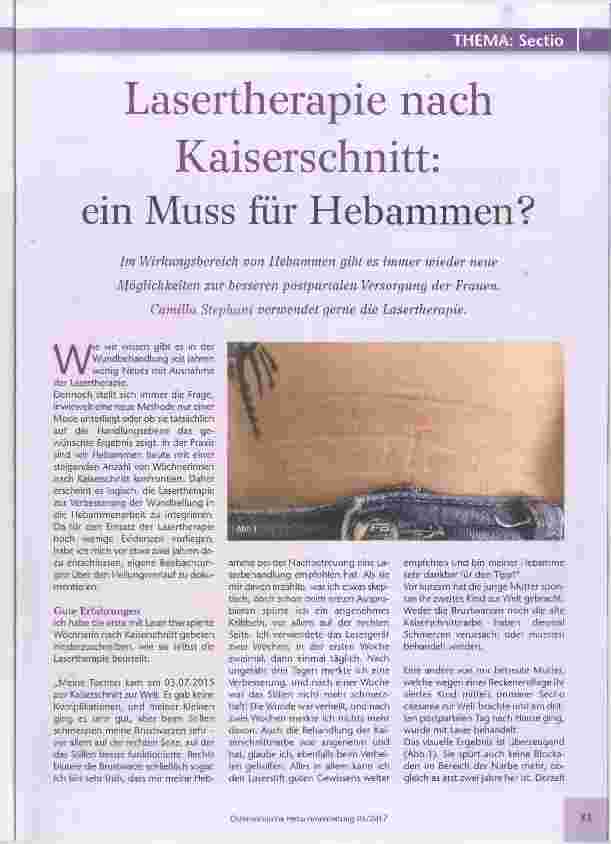 Vorschauseite 1: Lasertherapie nach Kaiserschnitt: ein Muss für Hebammen?