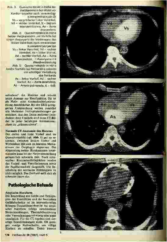 Vorschauseite 2: Kardio-Computertomographie