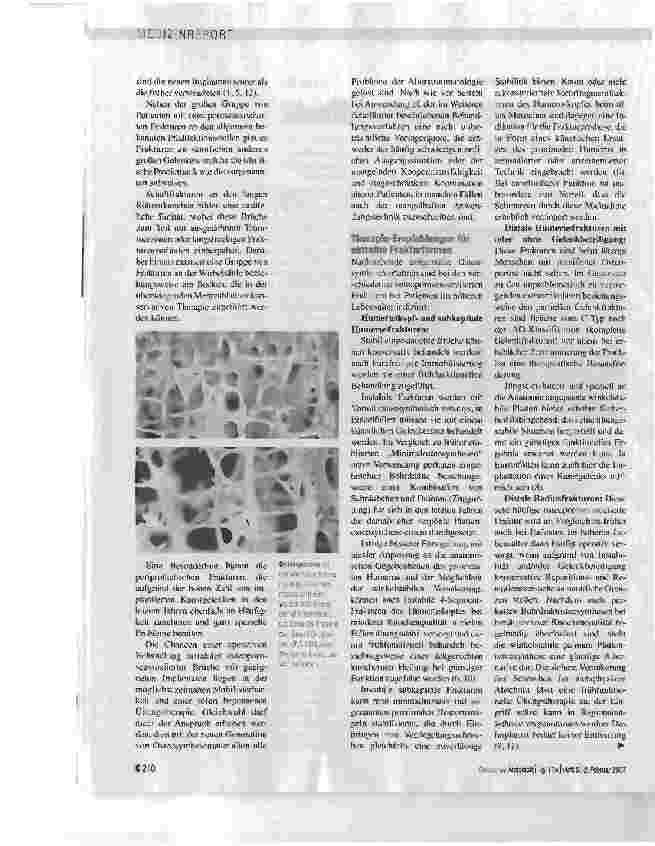 Vorschauseite 2: OSTEOPOROSEASSOZIIERTE FRAKTURENAlterstraumatologie eröffnet heute große Chancen