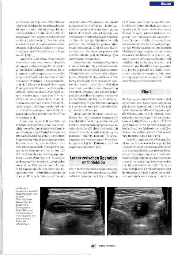 Vorschauseite 4: Epidemiologie, Prävention und Management von Infektionen ventrikuloperitonealer Shunts im Kindesalter