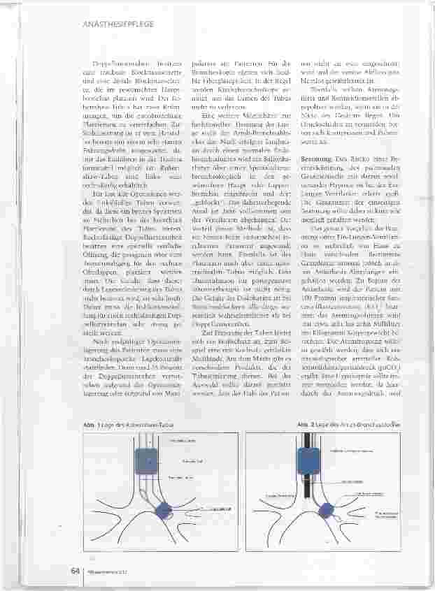 Vorschauseite 3: Ein-Lungen-Ventilation: Narkoseverfahren mit Risiken