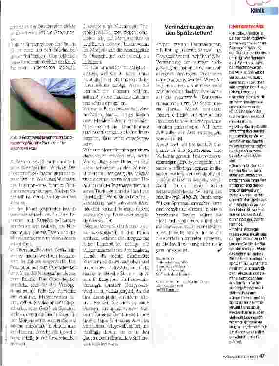 Vorschauseite 2: Tips zur Insulininjektion 2. Teil