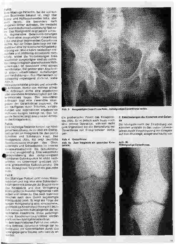 Vorschauseite 2: Radiologie 32. Folge: Röntgendiagnostik der Knochenund Gelenkerkrankungen