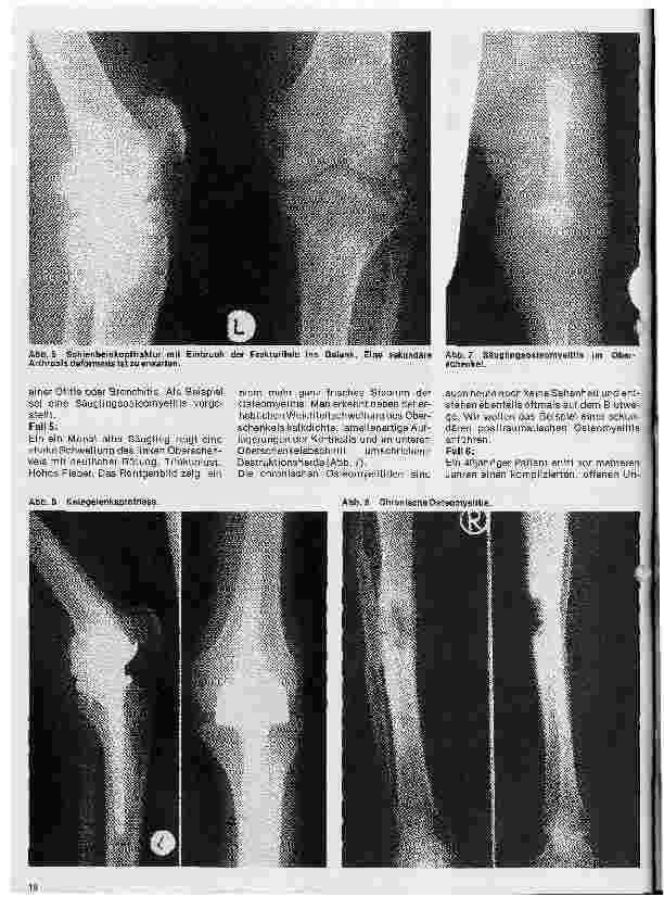 Vorschauseite 3: Radiologie 32. Folge: Röntgendiagnostik der Knochenund Gelenkerkrankungen