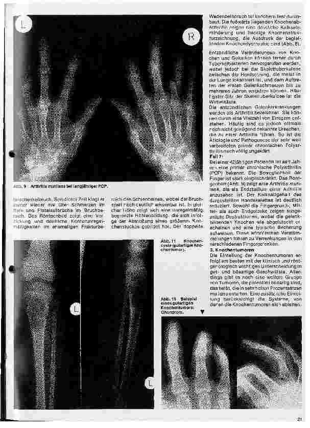 Vorschauseite 4: Radiologie 32. Folge: Röntgendiagnostik der Knochenund Gelenkerkrankungen