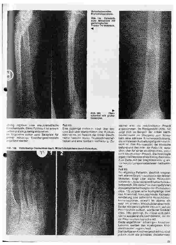 Vorschauseite 6: Radiologie 32. Folge: Röntgendiagnostik der Knochenund Gelenkerkrankungen