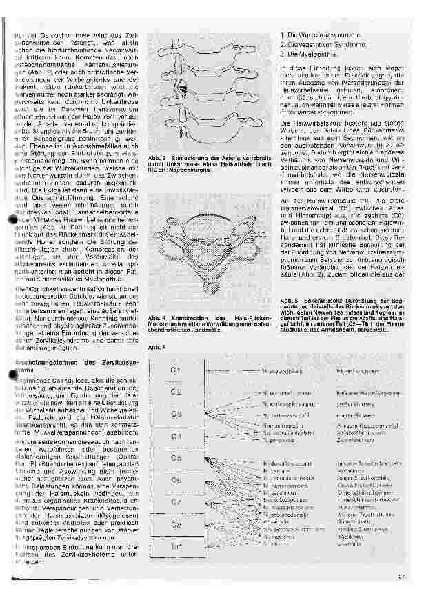 Vorschauseite 2: Themen aus der Neurochirurgie 5. Folge: Das Zervikalsymdrom