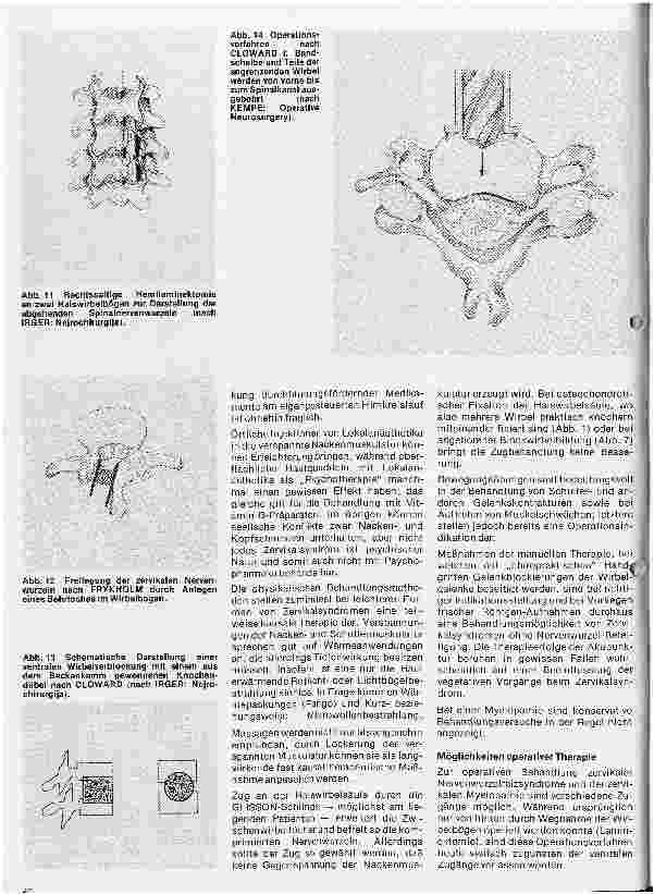 Vorschauseite 5: Themen aus der Neurochirurgie 5. Folge: Das Zervikalsymdrom