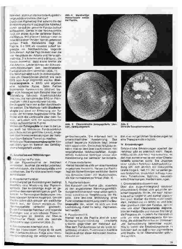 Vorschauseite 2: Einführung in die Augenheilkunde 10 Folge: Erkrankungen des Augenhintergrundes