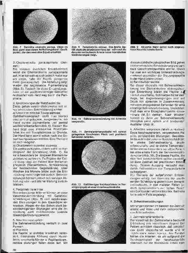 Vorschauseite 3: Einführung in die Augenheilkunde 10 Folge: Erkrankungen des Augenhintergrundes