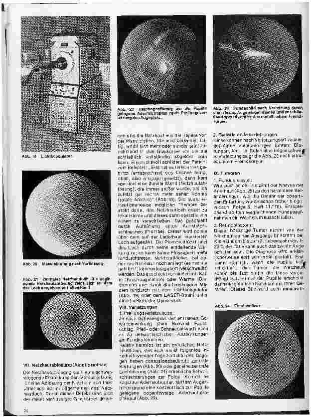 Vorschauseite 4: Einführung in die Augenheilkunde 10 Folge: Erkrankungen des Augenhintergrundes