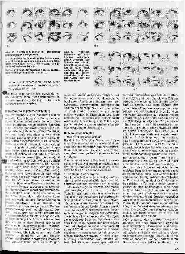 Vorschauseite 4: Einführung in die Augenheilkunde 11. Folge: Motilitätsstörungen
