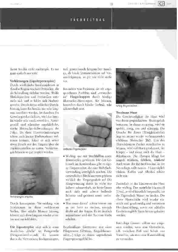 Vorschauseite 2: Diabetes ist auch Hautsache!