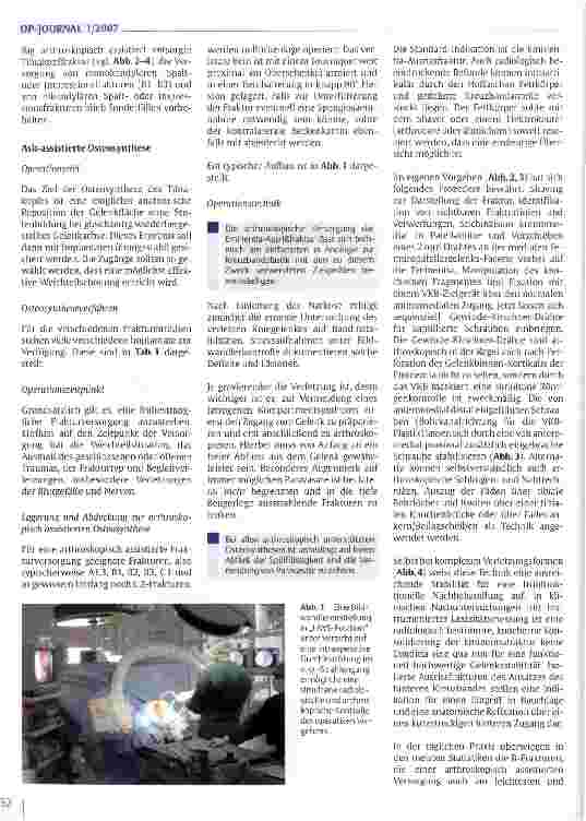 Vorschauseite 3: Arthroskopisch assistierte Behandlung von Tibiakopffrakturen