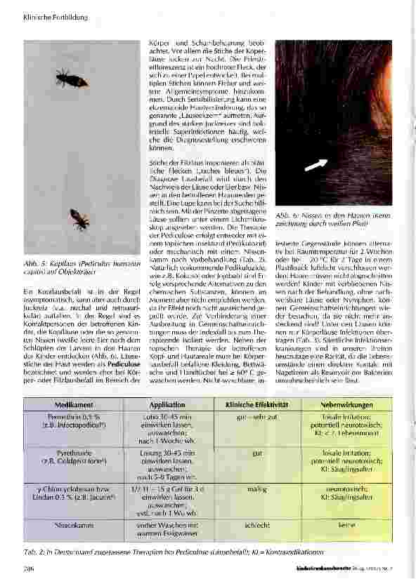 Vorschauseite 4: Läuse, Flöhe und anderes Getier