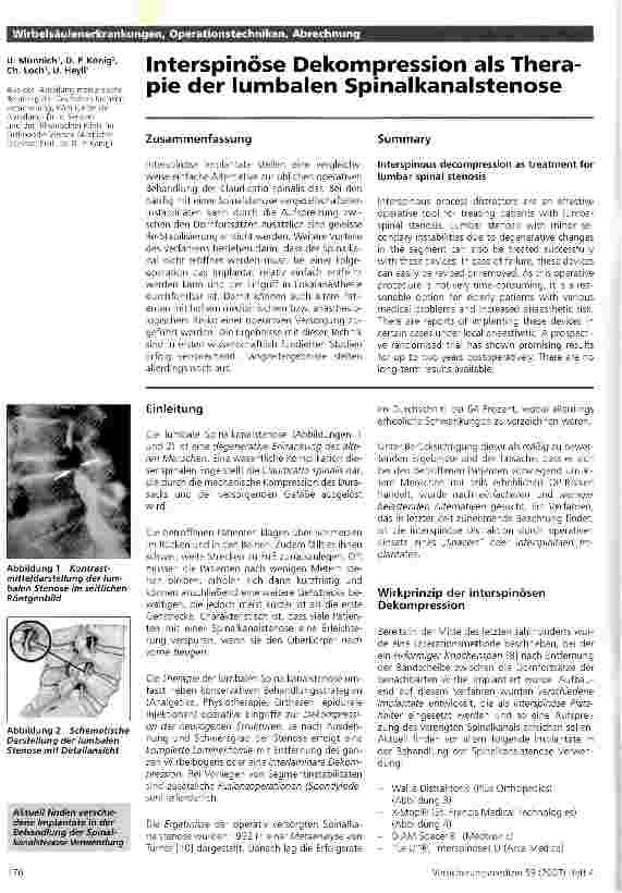 Vorschauseite 1: Interspinöse Dekompression als Therapie der lumbalen Spinalkanalstenose