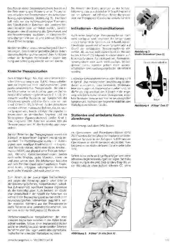 Vorschauseite 2: Interspinöse Dekompression als Therapie der lumbalen Spinalkanalstenose