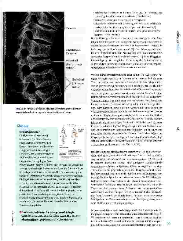 Vorschauseite 2: Prävention osteoporosebedingter Wirbelfrakturen Handeln, bevor der Knochen sintert