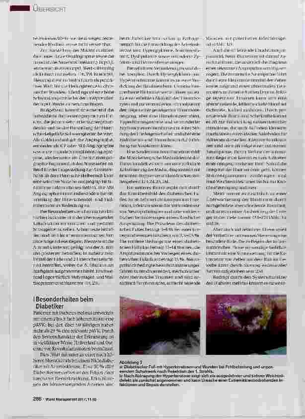 Vorschauseite 4: Kritische Extremitätenischämie und Diabetes mellitus im Kontext: Revaskularisation oder Amputation?