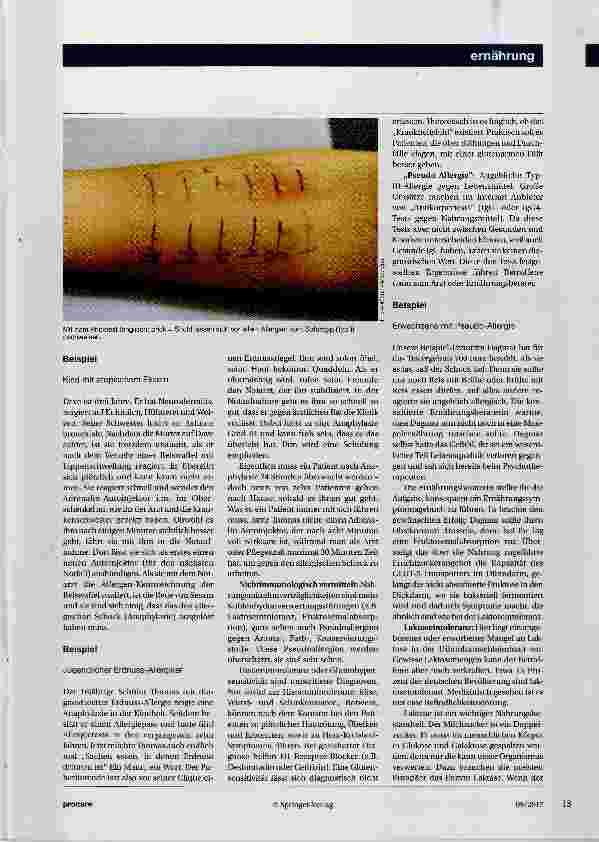 Vorschauseite 2: Allergie oder Unverträglichkeit