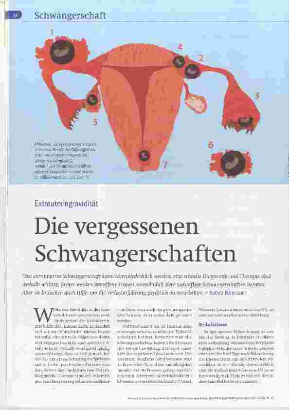 Vorschauseite 1: Die vergessenen Schwangerschaften