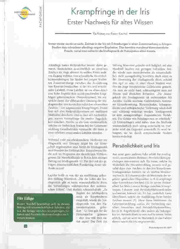 Vorschauseite 1: Krampfringe in der Iris Erster Nachweis für altes Wissen