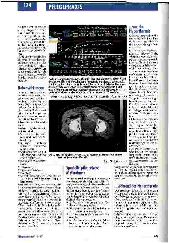 Vorschauseite 4: Hyperthermie: Eine neue onkologische Therapiemöglichkeit stellt besondere Anforderungen an die Pflege