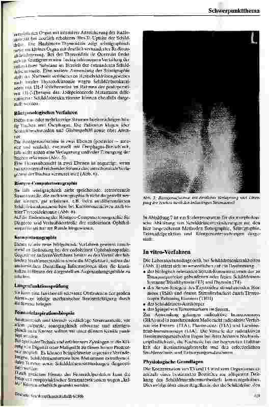 Vorschauseite 5: Diagnostik bei Schilddrüsenkrankheiten
