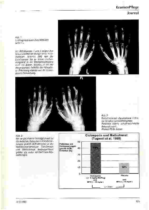 Vorschauseite 2: Behandlung von rheumatoider Arthritis Sandimmun Optoral jetzt auch in Deutschland zugelassen