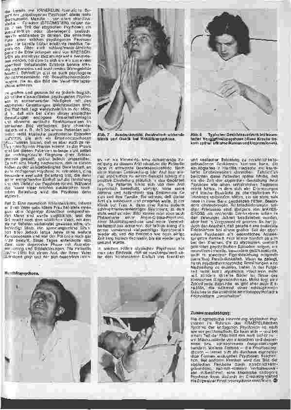 Vorschauseite 4: Die Schwester in der Psychiatrie 9. Folge: Endogene Psychosen c) Atypische Gestaltungen