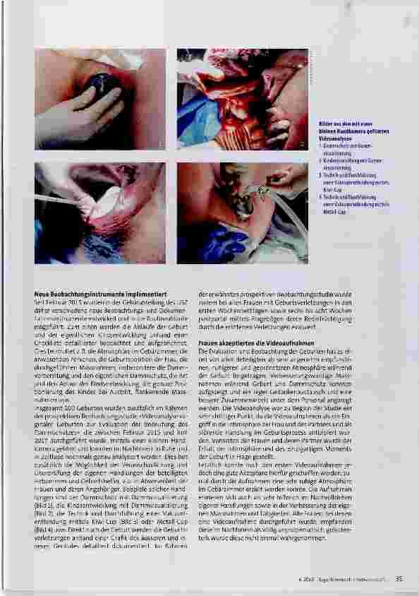 Vorschauseite 2: Qualitätsfördernde Massnahmen vaginaler Geburten inkl. Videoanalyse