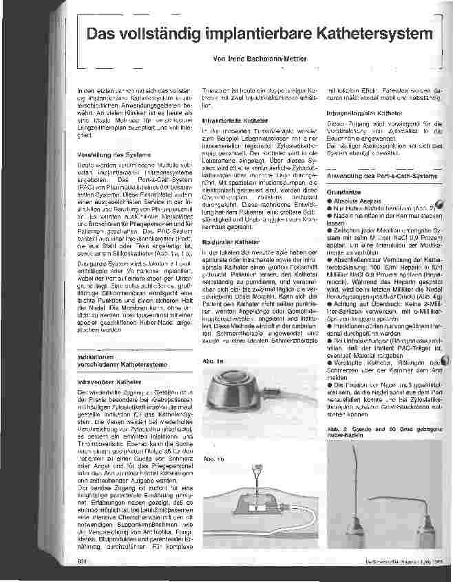 Vorschauseite 1: Das vollständig implantierbare Kathetersystem