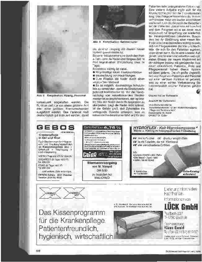 Vorschauseite 4: Das vollständig implantierbare Kathetersystem