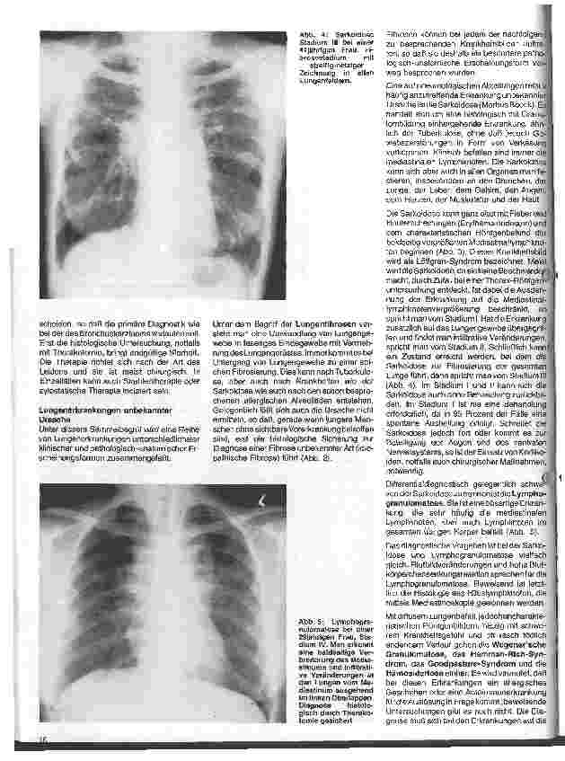 Vorschauseite 3: Aktuelle Themen aus der Pneumologie 6. Folge: Lungenerkrankungen