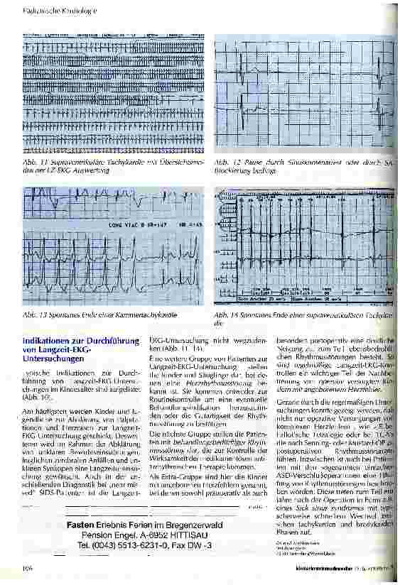 Vorschauseite 4: Langzeit-EKG zur Diagnose von angeborenen und postoperativen Rhythmusstörungen