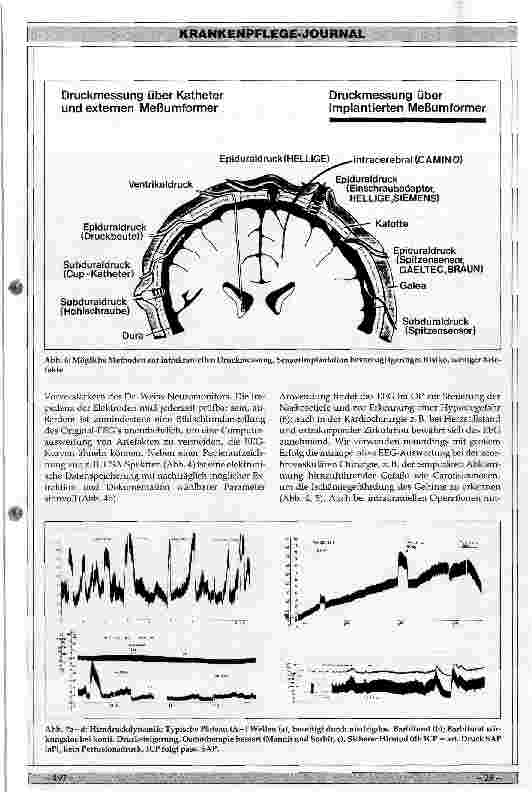 Vorschauseite 5: Erweitertes zerebrales Monitoring- Möglichkeiten in Neurochirurgie und benachbarten Fachgebieten