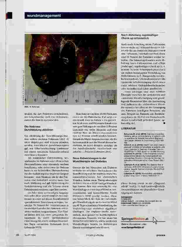 Vorschauseite 4: Wundversorgung beim diabetischen Fußsyndrom