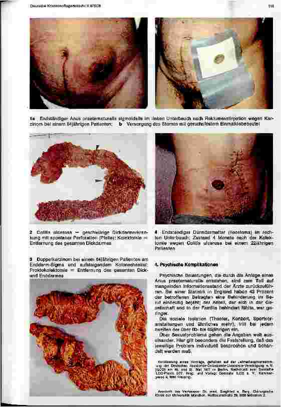 Vorschauseite 2: Komplikationen beim Anus praeter naturalis