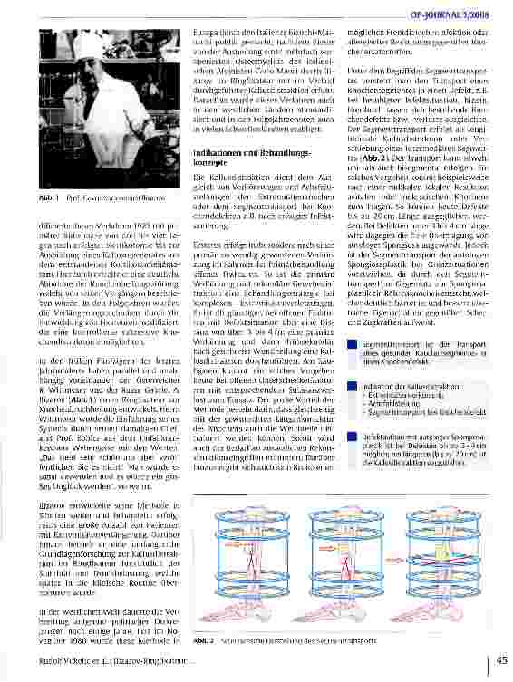 Vorschauseite 2: Ilizarov-Ringfixateur - ein Verfahren zur Kallusdistraktion