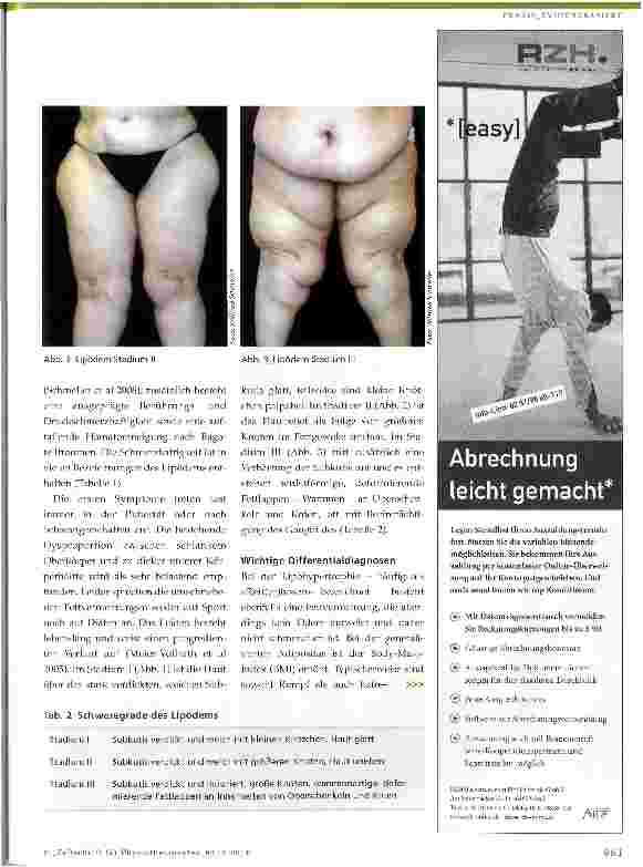 Vorschauseite 2: Lipödem: Neuer Stellenwert der Physiotherapie durch Kombination konservativer und operativer Maßnahmen