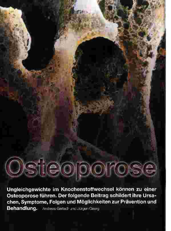 Vorschauseite 1: Osteoporose