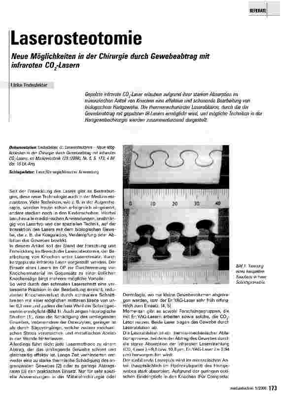 Vorschauseite 1: Laserosteotomie Neue Möglichkeiten in der Chirurgie durch Gewebeabtrag mit infraroten CQ2-Lasern