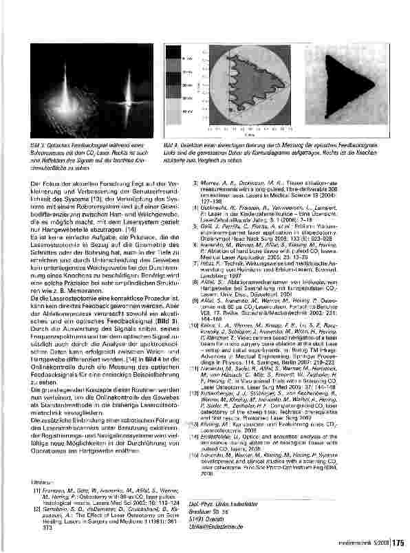 Vorschauseite 3: Laserosteotomie Neue Möglichkeiten in der Chirurgie durch Gewebeabtrag mit infraroten CQ2-Lasern